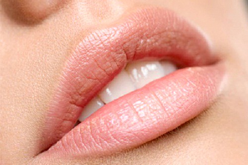 Implants lèvres PermaLip - repulper les lèvres en Tunisie