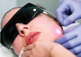 Endolift laser en Tunisie