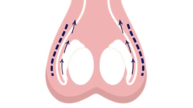 Lifting testicules tombants Tunisie prix abordables et pas cher