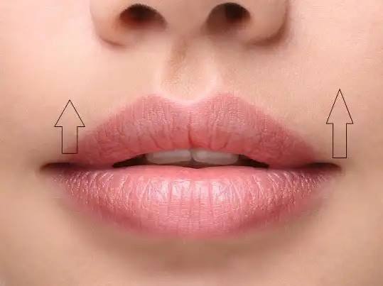 Lip Lift - Traitement en Tunisie