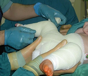 traitement de la luxation de la hanche en tunisie prix tarif pas cher