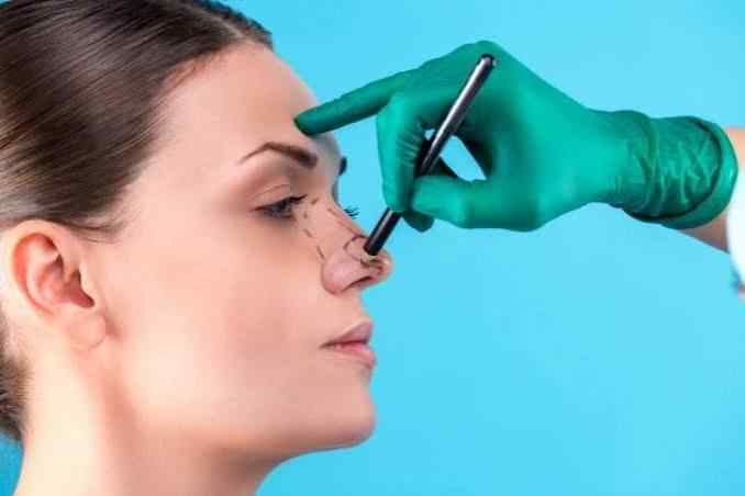 Rhinoplastie Structurelle - Traitement en Tunisie